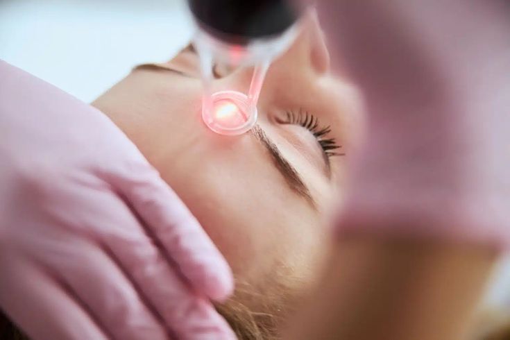 Công nghệ laser CO2 là gì